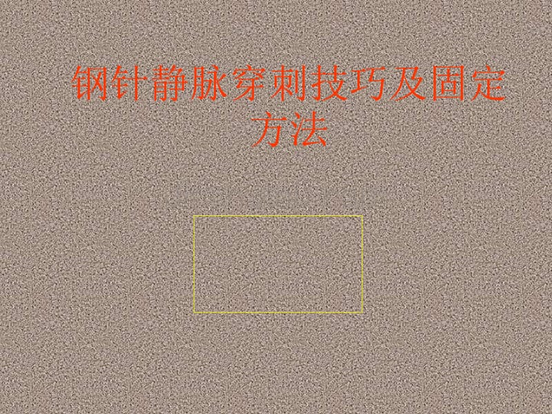 钢针静脉穿刺及固定方法_第1页