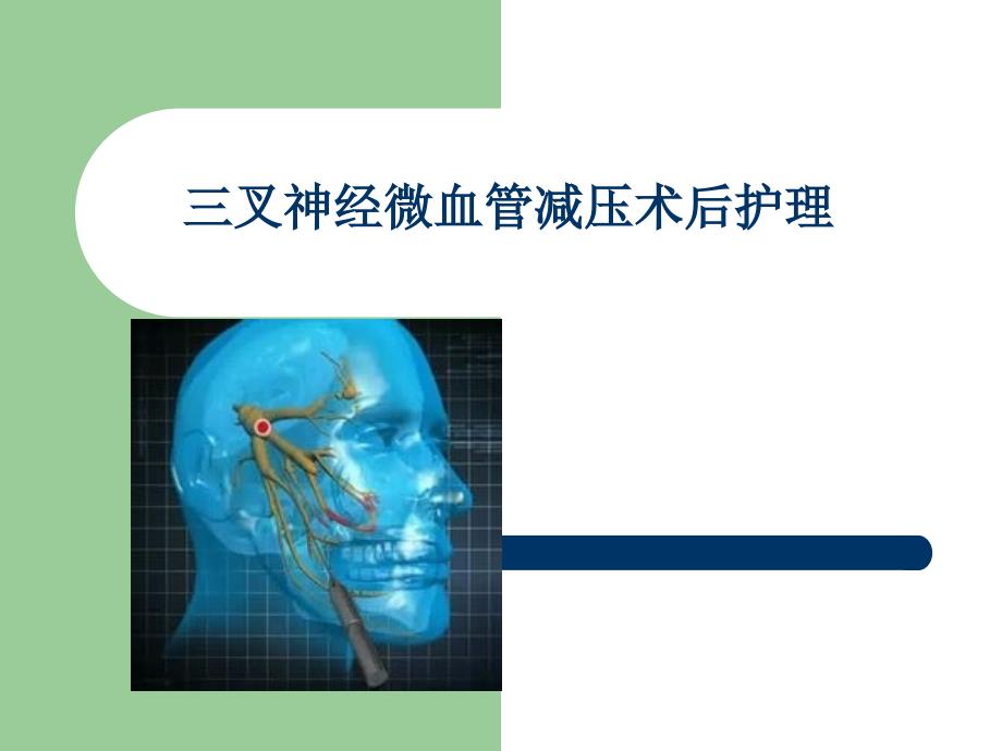 三叉神经微血管减压术后护理_第1页
