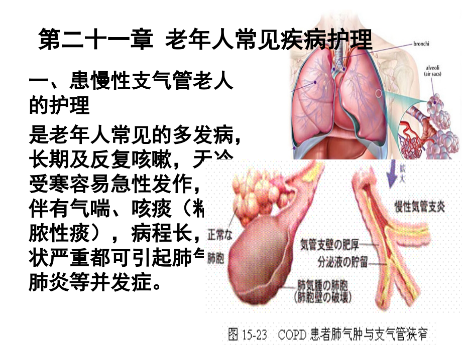 第二十一章 老年人常见疾病的护理_第2页