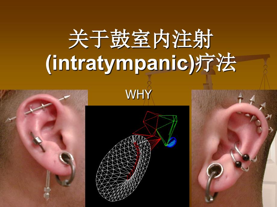 关于鼓室注射_第1页