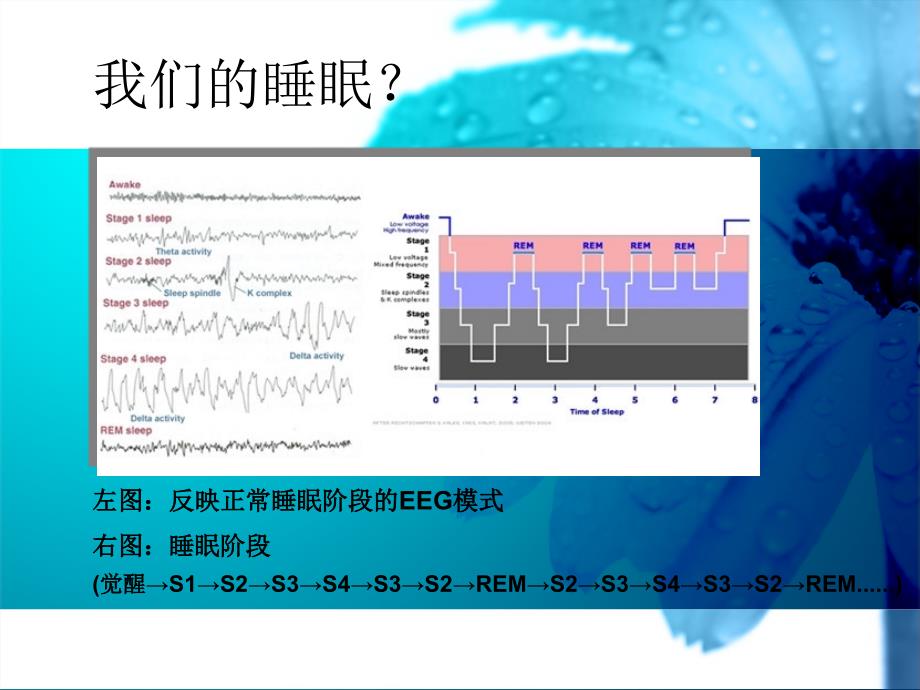 护考辅导睡眠障碍_第2页