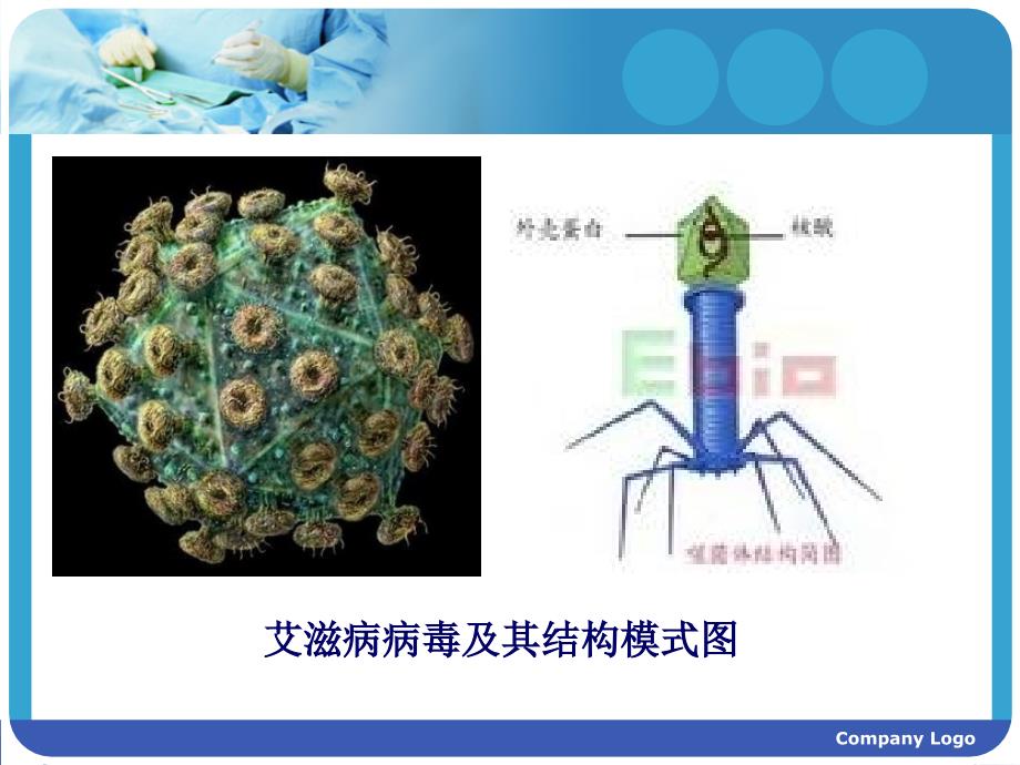 获得性免疫缺陷综合征病人的护理_第4页