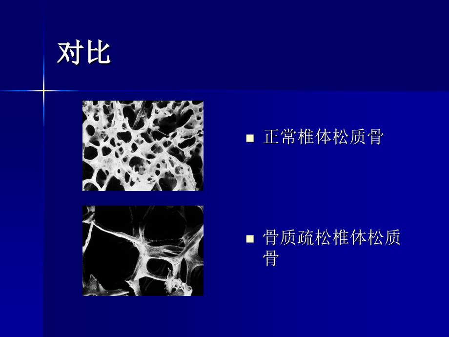 骨质疏松症诊治规范_第4页