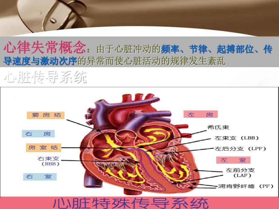 心律失常介入治疗及护理学生新_第3页