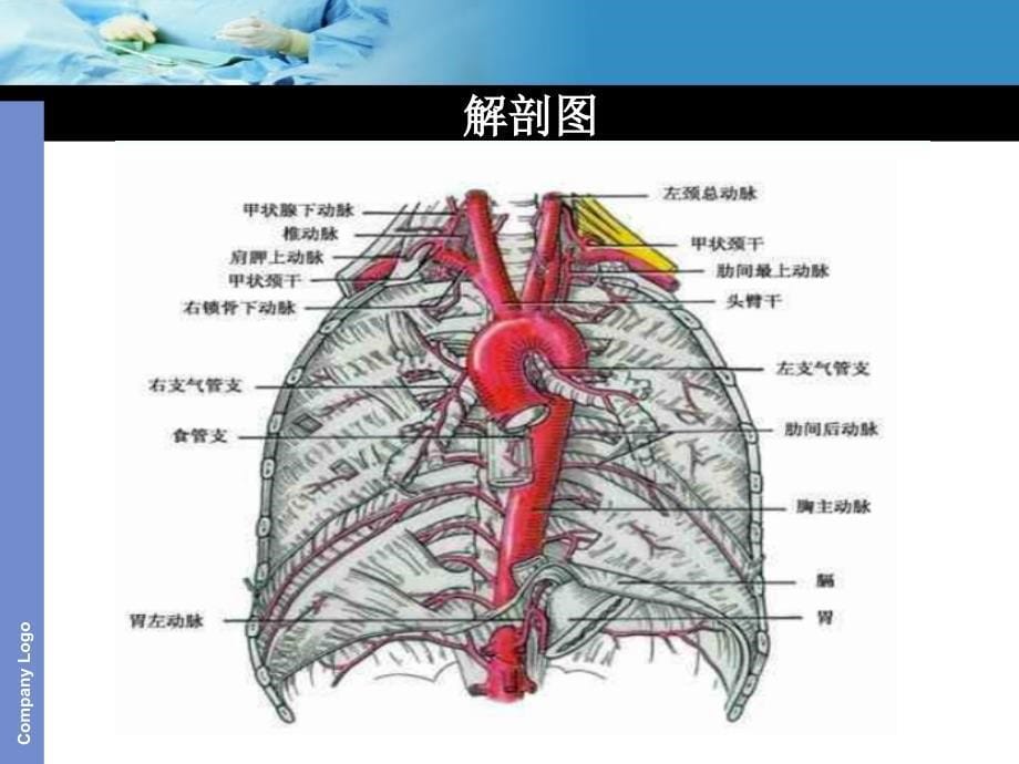 主动脉夹层护理查房_第5页