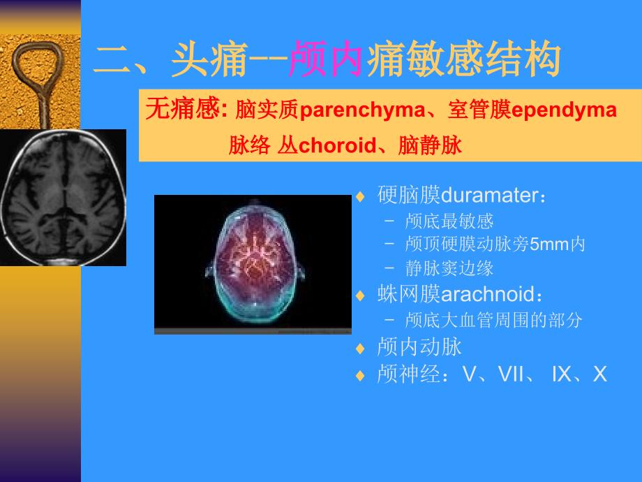 头痛的诊断策略_第4页