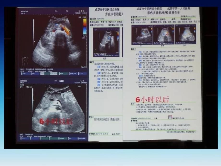 急诊窗旁超声临床应用培训讲座总结整理_第5页