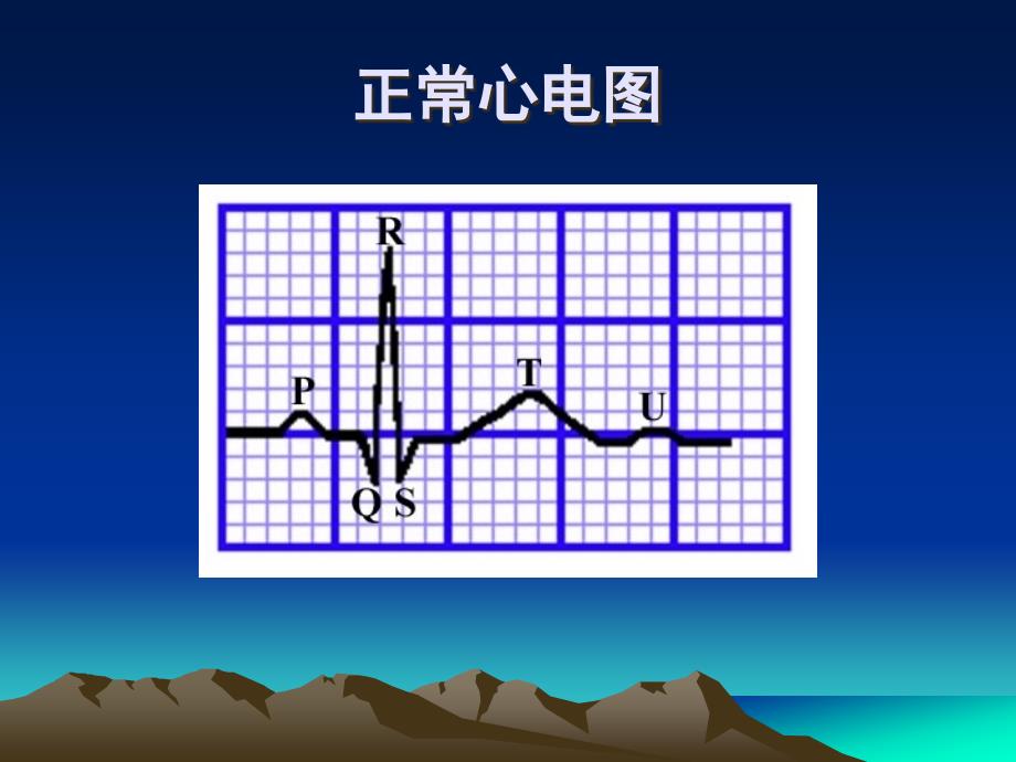 急性冠状动脉综合征急诊处理_第2页