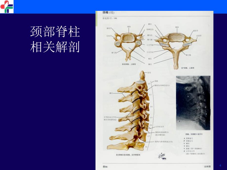 颈椎病临床和影像学诊断刘修_第4页