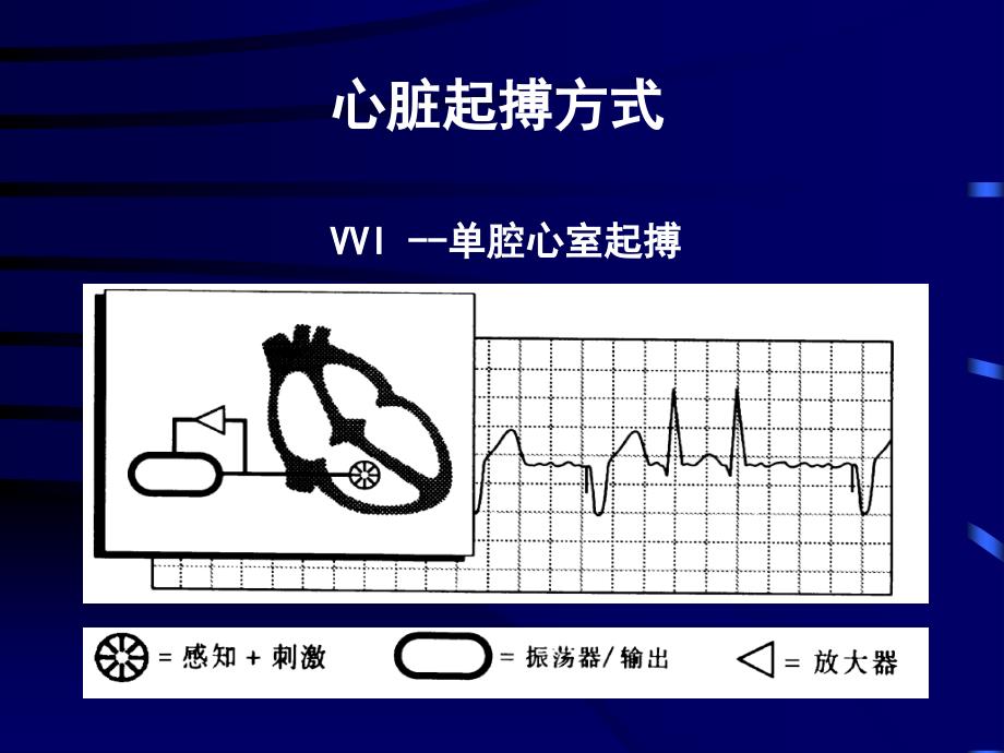 心脏起搏器适应证与应用_第3页