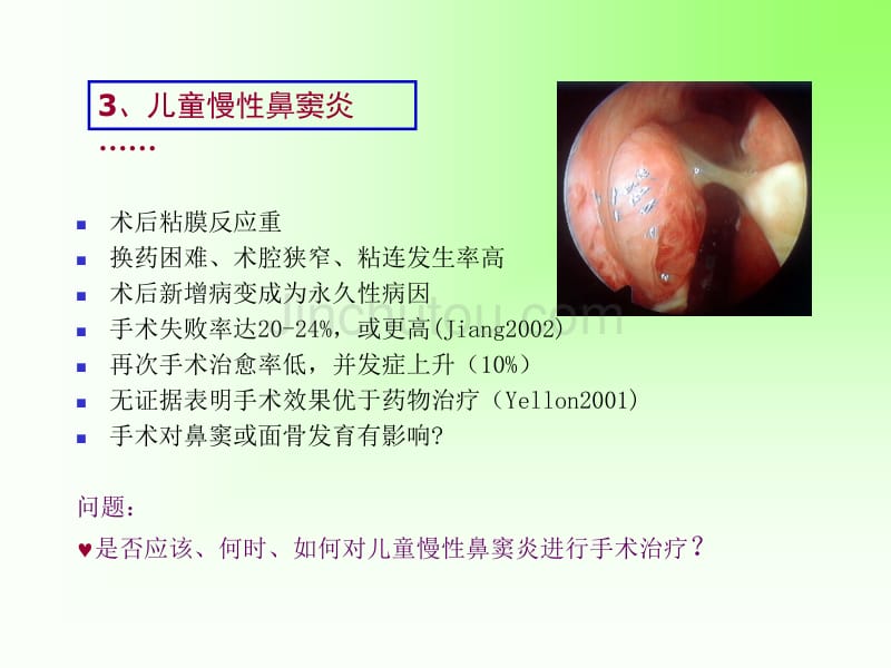 儿童慢性鼻窦炎_第5页