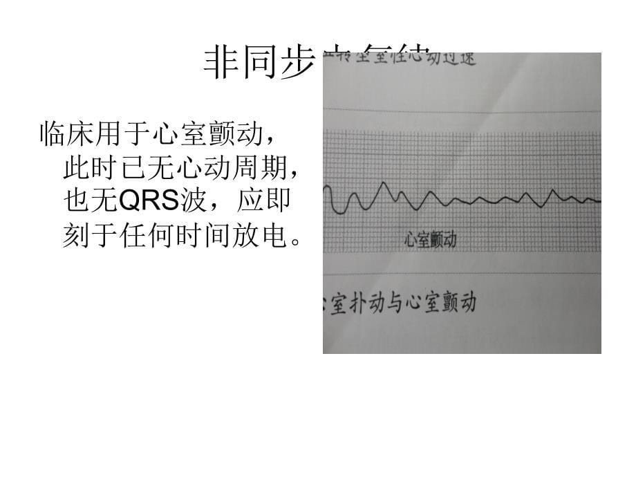 除颤仪操作_第5页