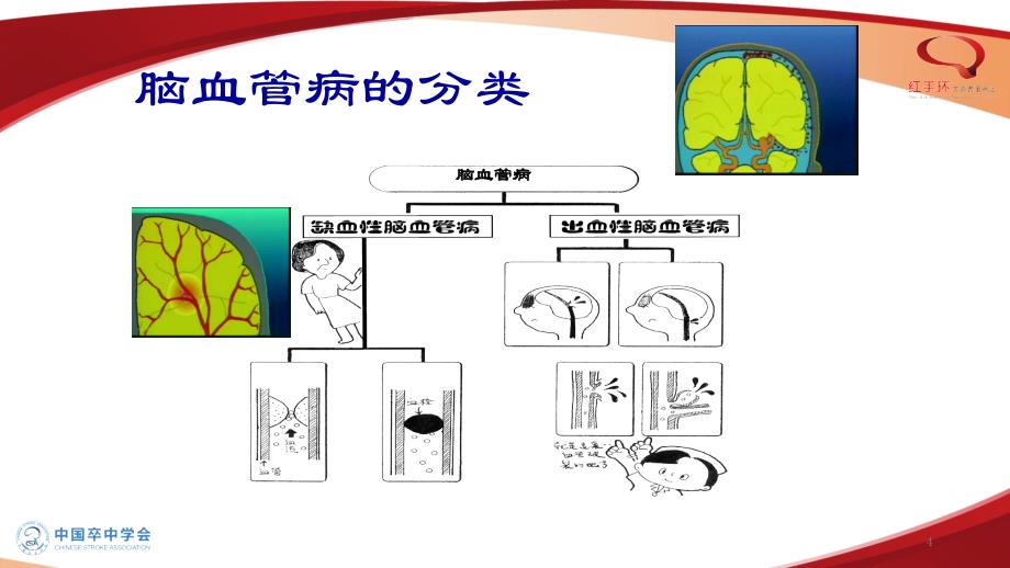 卒中患者健康教育基础篇_第4页