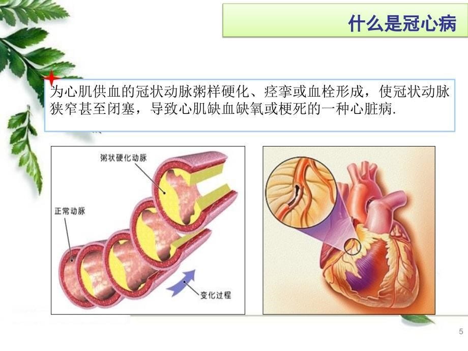 冠心病患教课要求_第5页