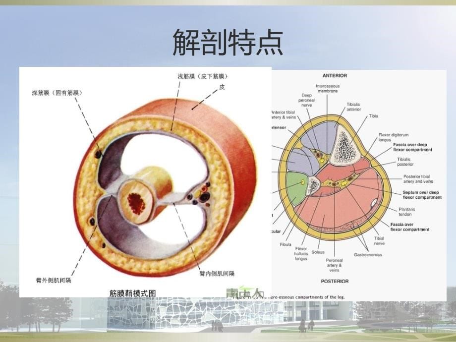 骨筋膜室综合征护士讲课_第5页