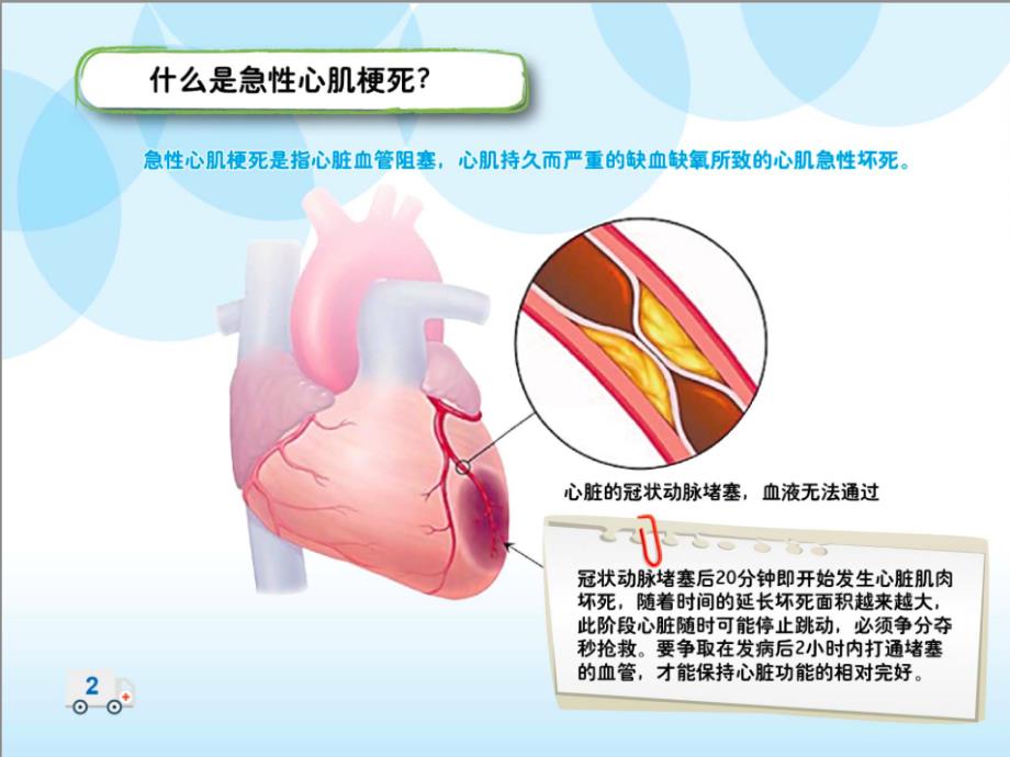 患者教育心肌梗死_第4页