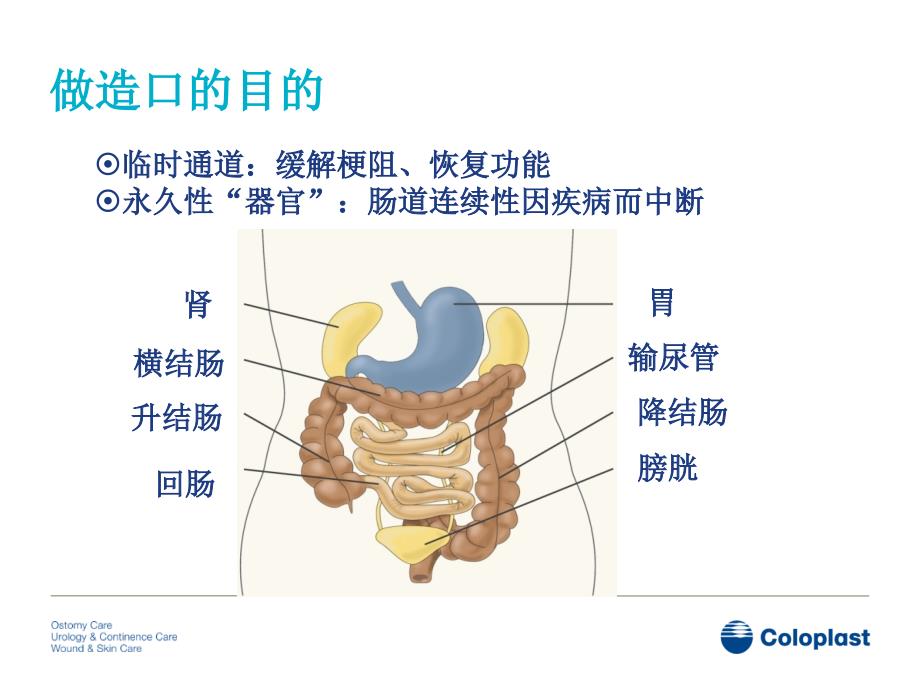 造口基础知识及造口护理发展_第4页
