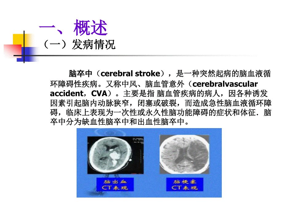 高压氧在脑卒中患者康复中的临床机制及应用_第3页