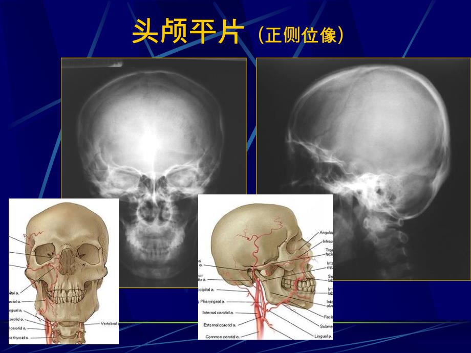 中枢神经系统正常及异常影像改变北京协和医院_第3页
