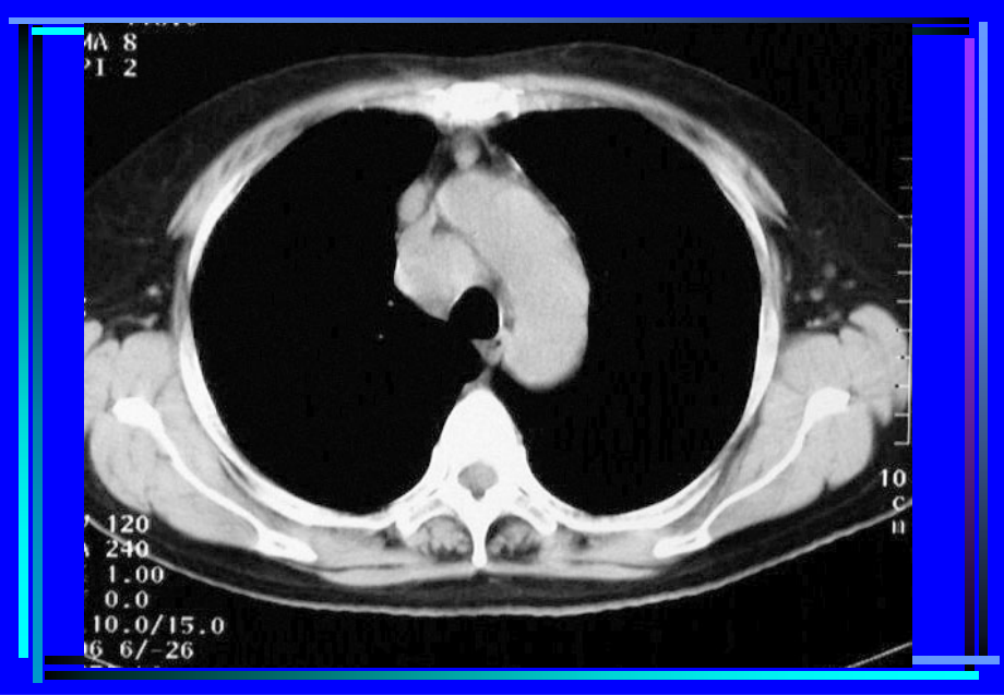 胸部CT诊断【课件】_第4页