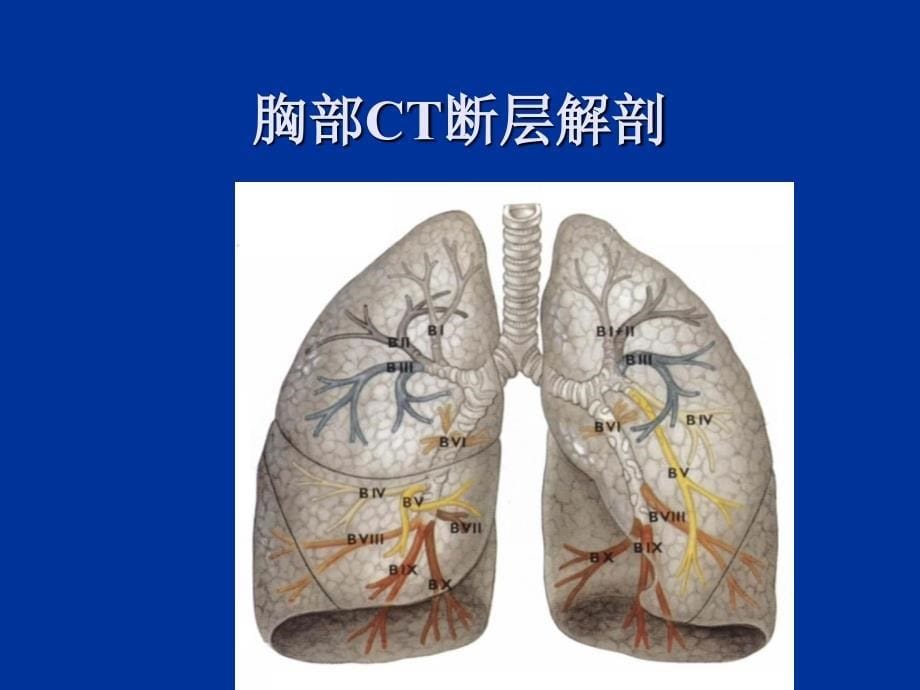 肺部常见疾病CT读片_第5页