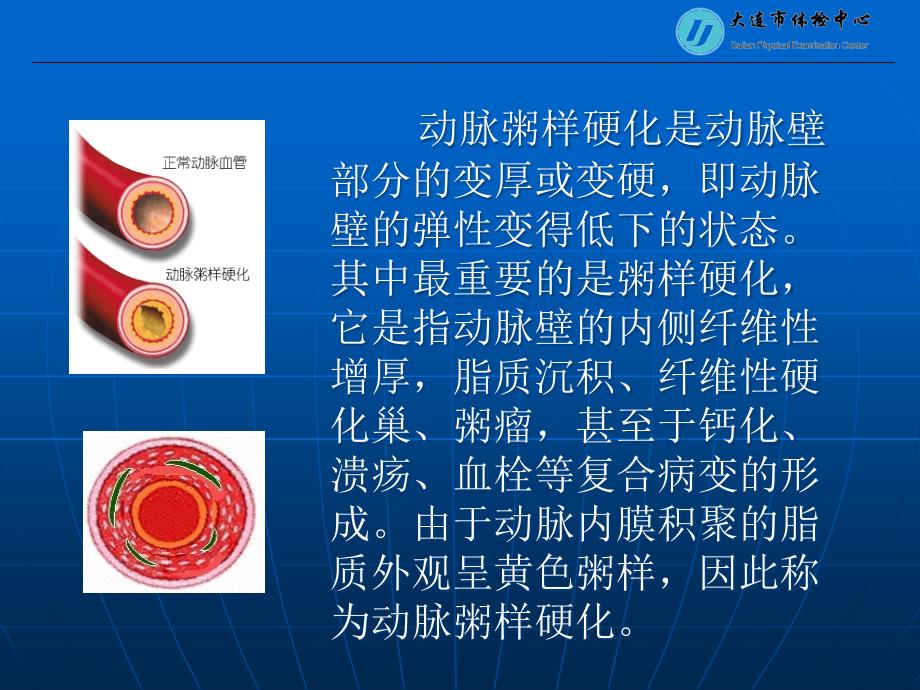 动脉硬化检测_第4页