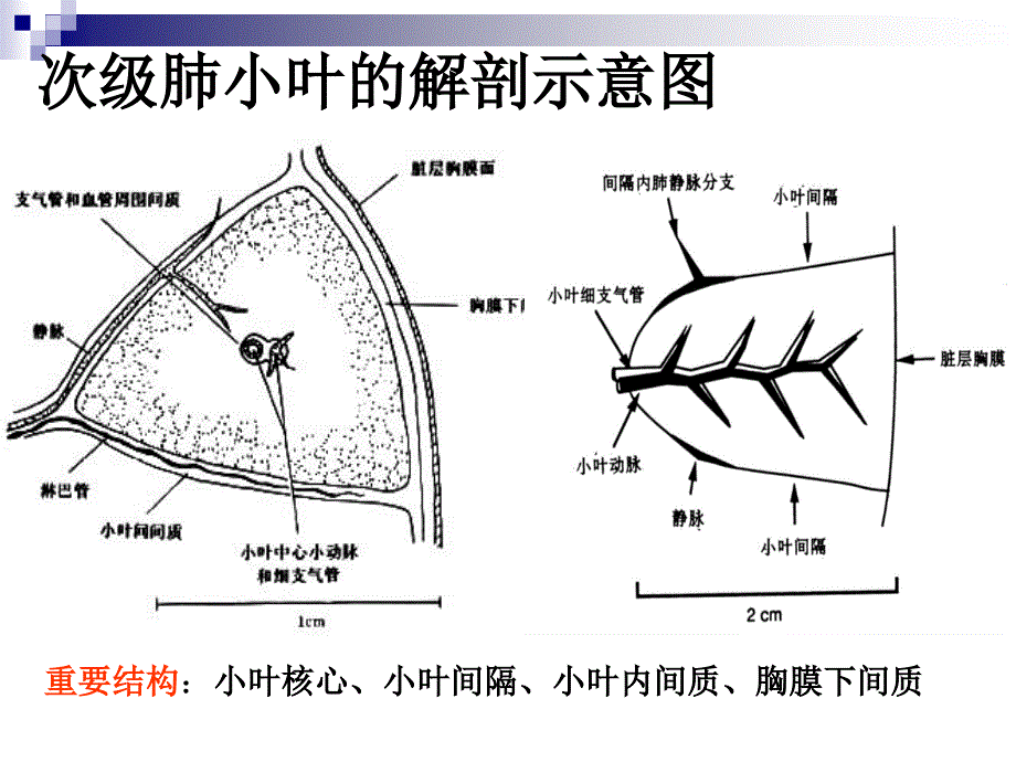 肺部间质病的基本病变影像_第2页