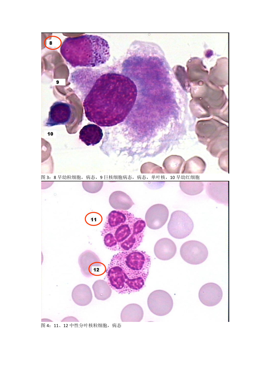 血细胞鉴别欧洲共识报告附图_第2页