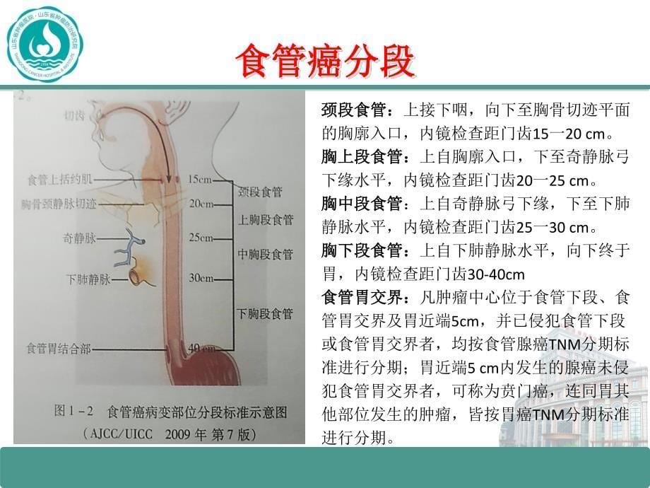 螺旋断层放疗在食管癌中的应用_第5页