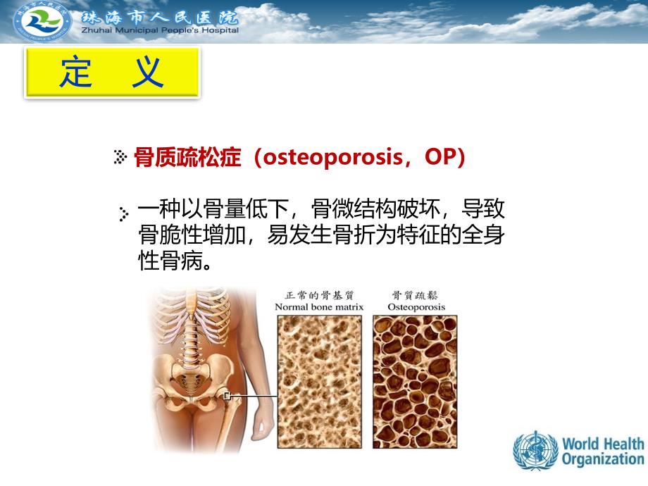 原发性骨质疏松症的诊断_第3页