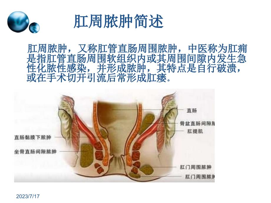 一例肛周脓肿术后换药个案_第3页