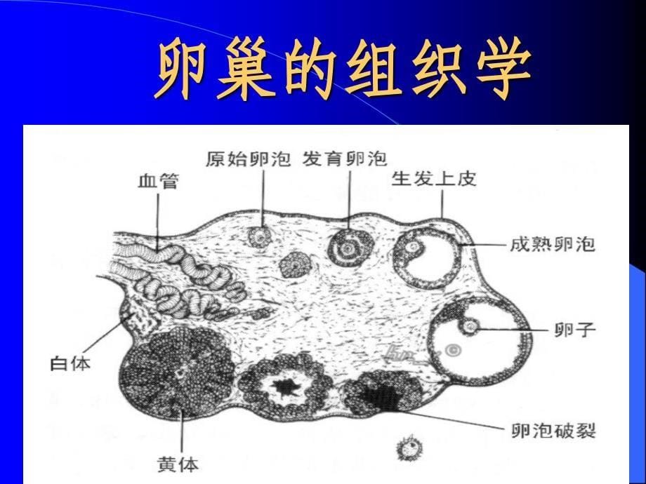 临床病理——卵巢肿瘤病理_第5页