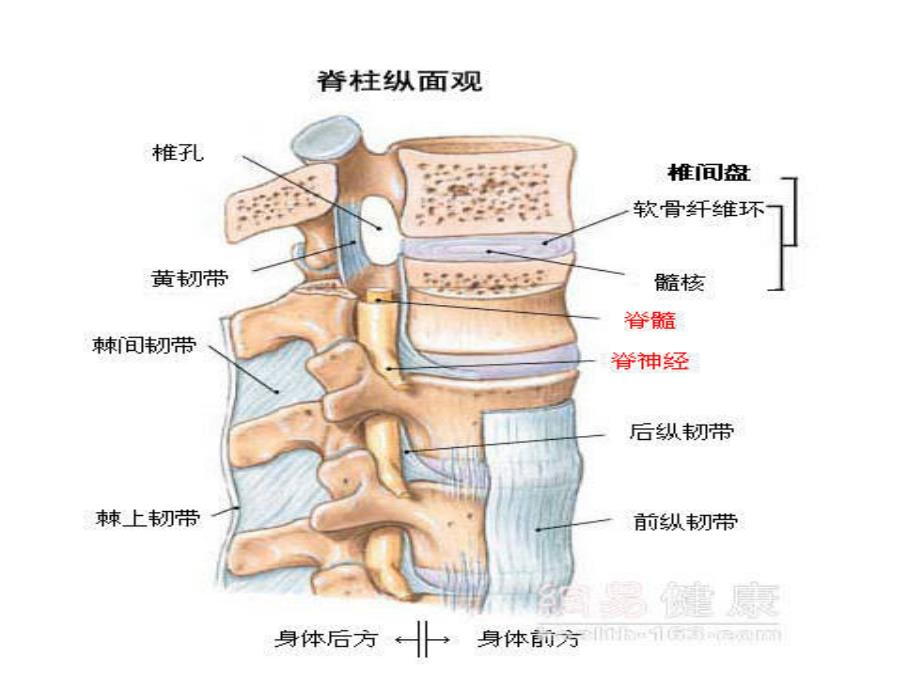 腰椎间盘突出症护理_第4页