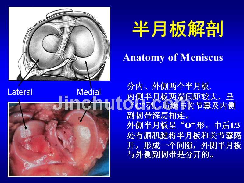 半月板损伤讲课修改版_第2页