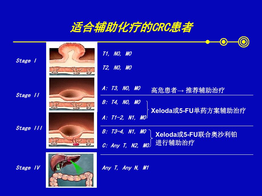 希罗达结直肠癌_第4页