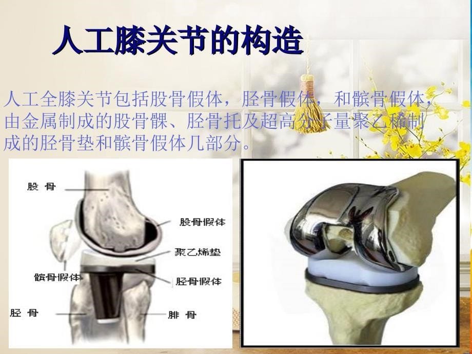 全膝关节置换术护理及康复_第5页