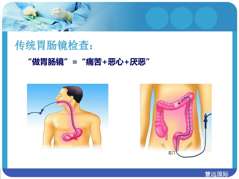 无痛胃肠介绍_第4页