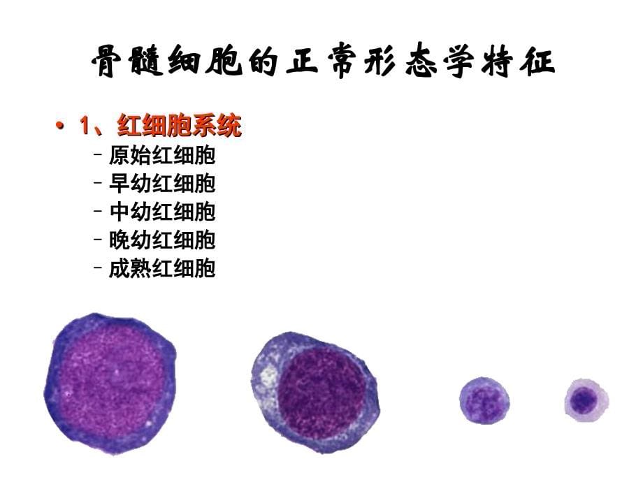 血液骨髓疾病的实验室诊断_第5页