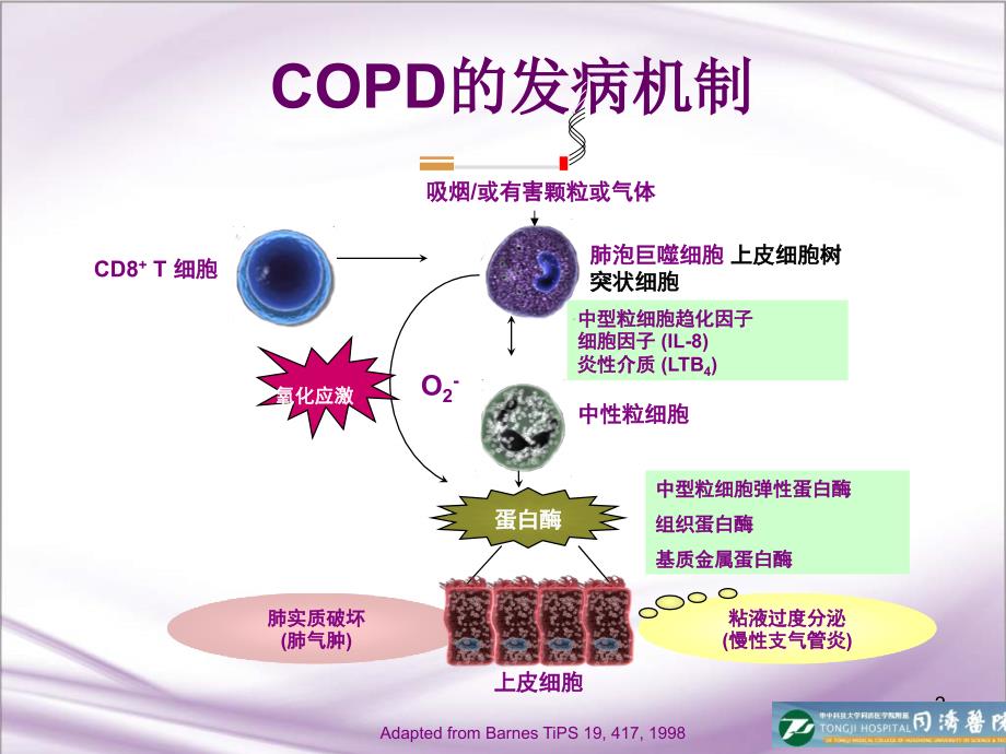 抗氧化在慢阻肺临床治疗中的重要性_第2页