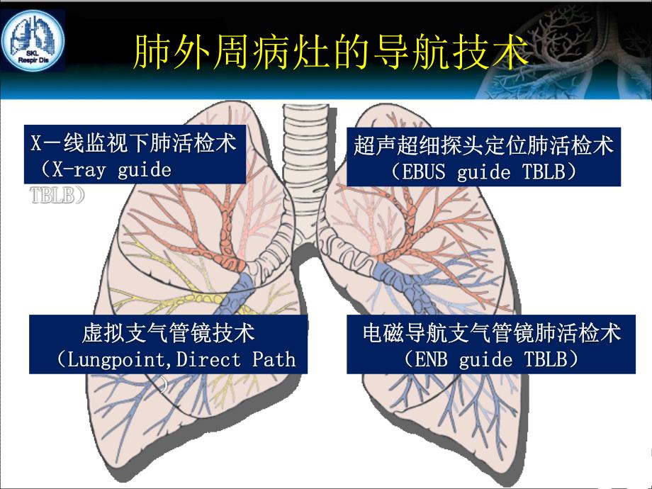 电磁导航支气管镜技术在介入肺脏病的应用_第2页