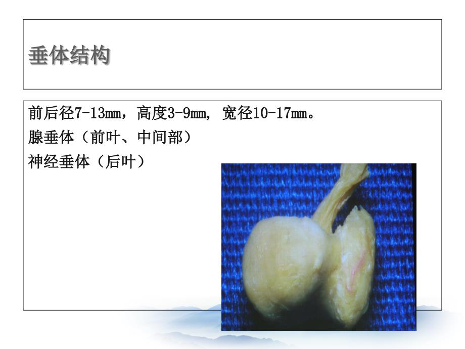 内分泌危象之垂体危象_第3页