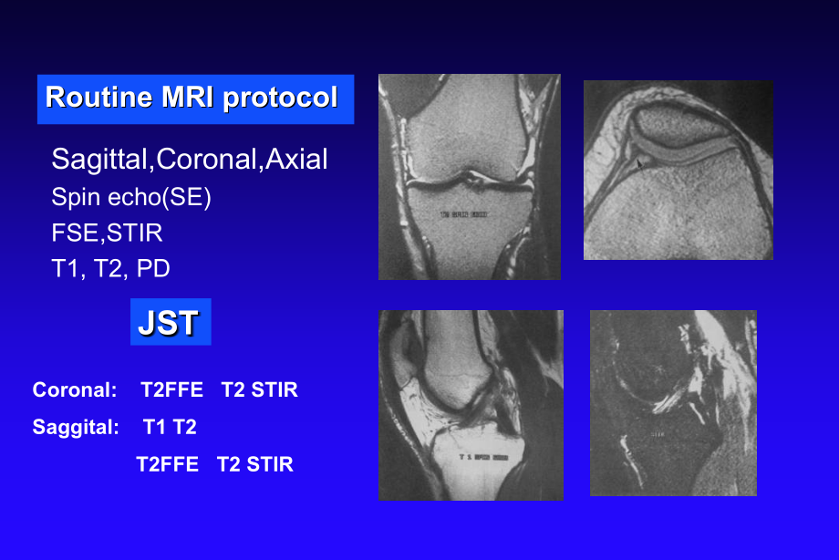 积水潭膝关节MRI_第2页