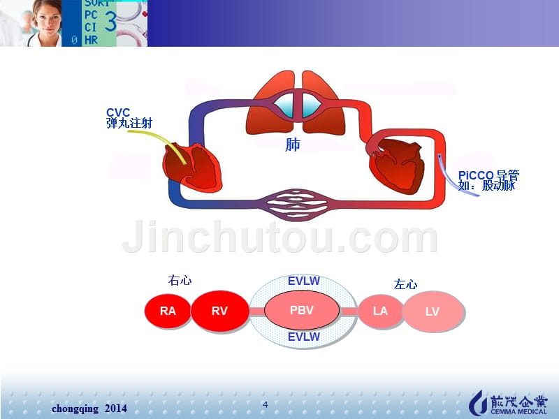 PiCCO 技术原理和临床意义_第4页