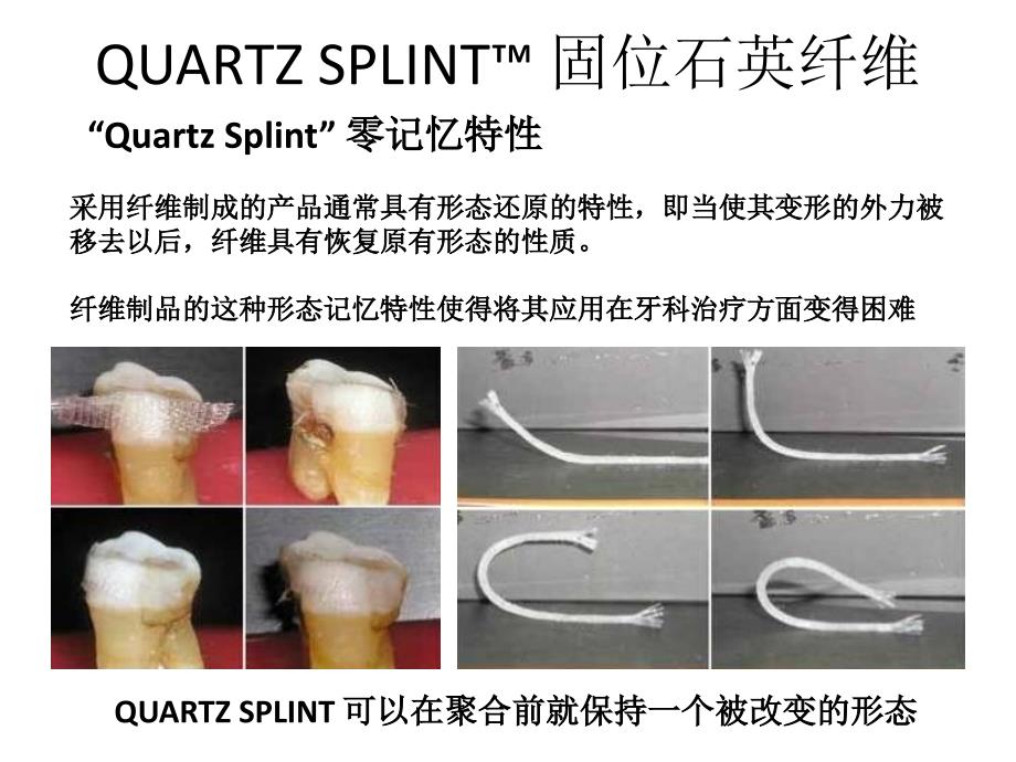 石英纤维夹板在正畸保持中的应用_第4页