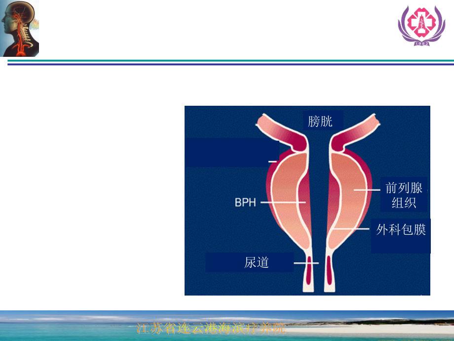 前列腺增生症的诊断治疗_第3页