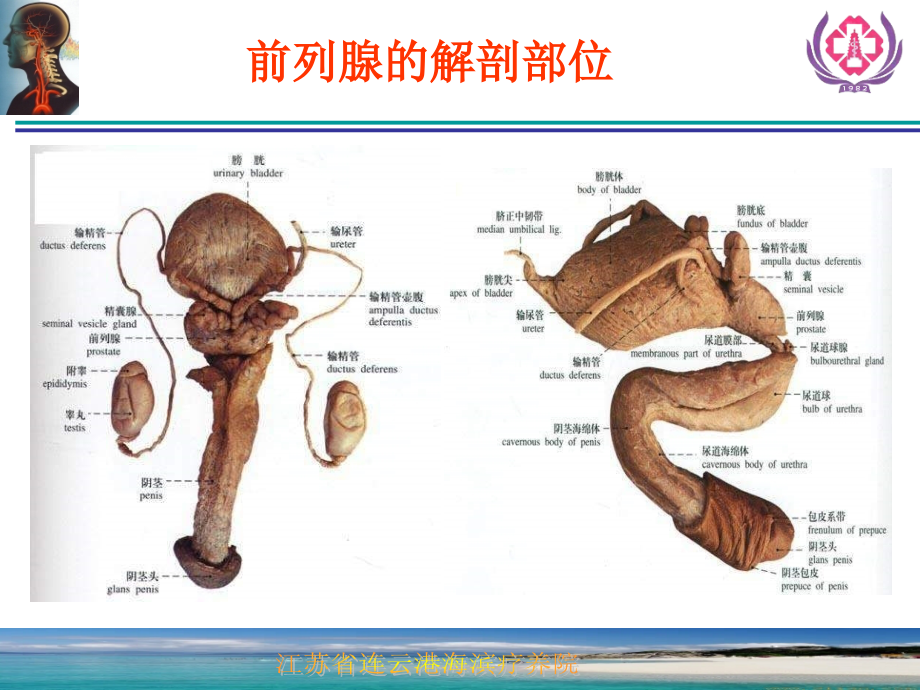 前列腺增生症的诊断治疗_第4页