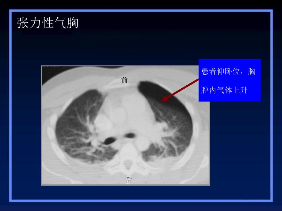 19个医生必看的影像学改变_第3页