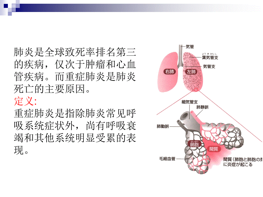 重症肺炎的护理_第2页