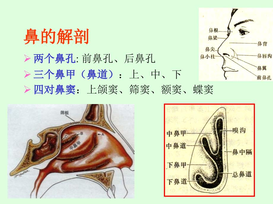 上颌窦炎.acute_第2页