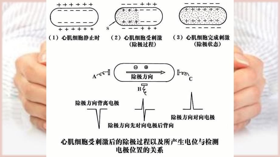 常见心电图的基本识别_第5页